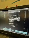 SIEMENS Acuson X700 Ultrasound  with 3 Probes
