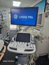 GE Logiq P9 Ultrasound - Shared Service