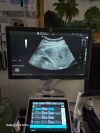 GE Logiq P9 Ultrasound - Shared Service