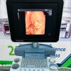 GE Voluson P8 Ultrasound - OB / GYN