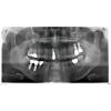 SIRONA XG Pan + Ceph with PC, Software and Warranty Dental X-Ray