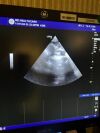 GE HEALTHCARE 3SC-RS Ultrasound Transducer