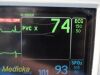 GE Dash 3000,(Masimo SpO2 CO2 T/CO 2X IBP NBP ECG) W/ NEW Leads ~ Monitor