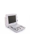 EDAN DUS 60 Portable ultrasound scanner