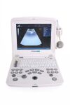 EDAN DUS 60 Portable ultrasound scanner