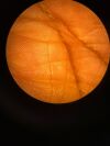 CARL ZEISS S7 Microscope OPMI VISU 150 Opthalmology Microscope