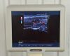 MEDISON SonoAce X6 Ultrasound System w/ C2-8 Transducer - 195031 SonoAce X6