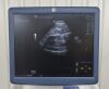 GE LOGIQ E9 Ultrasound System W/ 4 Probes,  ML6-15-D, 9L-D, S4-10-D, &amp; M5S-D Transducers - 195071 LOGIQ E9