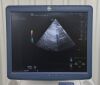 GE LOGIQ E9 Ultrasound System W/ 4 Probes,  ML6-15-D, 9L-D, S4-10-D, &amp; M5S-D Transducers - 195071 LOGIQ E9