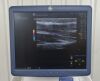 GE LOGIQ E9 Ultrasound System W/ 4 Probes,  ML6-15-D, 9L-D, S4-10-D, &amp; M5S-D Transducers - 195071 LOGIQ E9