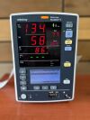 DATASCOPE Accutorr V BP Monitor