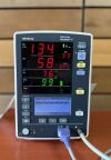 DATASCOPE Accutorr V BP Monitor