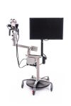 OLYMPUS OCS-2 colposcope (video track)