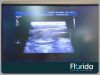PHILIPS 453561177104  PHILIPS L9-3 LINEAR ARRAY TRANSDUCER PROBE REF 453561177104 TESTED ** 30 DAYS WARRANTY Ultrasound Accessories