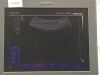 SIEMENS ACUSON ANTARES 10131661 Ultrasound - OB / GYN