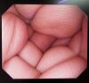 OLYMPUS GIF-Q260 Endoscope