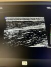 PHILIPS L12-3 Ultrasound Transducer