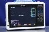 INVIVO US42707985 Monitor