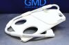 RAPID BIOMEDICAL 1643 Siemens MRI  Frame Breast Coil w/Insert Plate Breast Coil