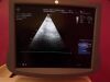 GE Ultrasound Ultrasound Transducer