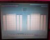 BIO-LOGIC Audiometer AEP EEG  w/ Laptop & Cart EEG Unit