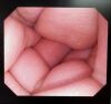 OLYMPUS GIF-Q240Z Endoscope