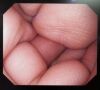 OLYMPUS GIF-H290Z Endoscope