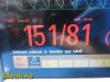 PHILIPS Intellivue X2 M3002A Ref 865039 Transport Monitor