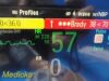 PHILIPS 2011  Intellivue X2 M3002A Transport Monitor