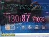 PHILIPS 2011  Intellivue X2 M3002A Ref 865039 Companion Monitor