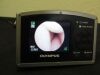 OLYMPUS MAF-TM Intubation Scope