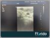 PHILIPS L9-3 LINEAR ARRAY ULTRASOUND TRANSDUCER PROBE TESTED REF 453561177104 30 DAYS WARRANTY Ultrasound Transducer