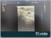PHILIPS L9-3 LINEAR ARRAY ULTRASOUND TRANSDUCER PROBE TESTED REF 453561177104 30 DAYS WARRANTY Ultrasound Transducer