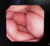 OLYMPUS GIF-N260 Endoscope
