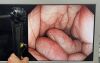 OLYMPUS GIF-HQ290 Gastroscope