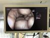 FUJI EG-6400N Gastroscope