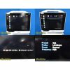 2015 eZono L3-12 NGS Linear Array Ultrasound Probe Ref 2006001, TESTED ~