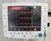 DATEX-OHMEDA GE Datex Ohmeda Aisys Carestation Anesthesia Machine 1011-9000-000 - 195425 Anesthesia Machine