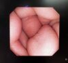 OLYMPUS GIF-XP240 Endoscope