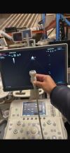 ESAOTE P1-5 Probe