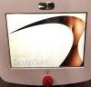 CYNOSURE INC SCULPSURE, 100-7026-010 LASER