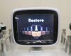 AQUALINA Sollift Restore 6 in 1 Cavitation System for Face and Body