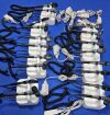 WELCH ALLYN 777 Diagnostic Set
