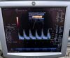 GE Logiq P5 Ultrasound - OB / GYN - Vascular