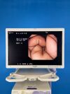 OLYMPUS Evis Lucera CV-260SL Endoscopy System