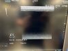 HITACHI L441 Ultrasound Transducer