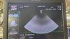 HITACHI S211 Ultrasound Transducer