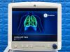 GE CaresCape R860 YOM: 2020 Ventilator