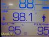 WELCH ALLYN 2013  45NTO Hill Rom Spot Vital Signs LXI Monitor