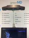 STRYKER OrthoMap Surgical Navigation System